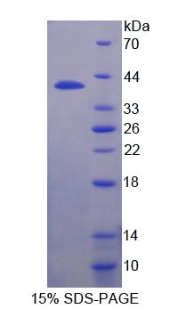 ICSBP / IRF8 Protein - Recombinant Interferon Regulatory Factor 8 By SDS-PAGE