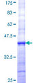 ICT1 / DS1 Protein - 12.5% SDS-PAGE Stained with Coomassie Blue.