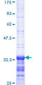 ID2 Protein - 12.5% SDS-PAGE Stained with Coomassie Blue.