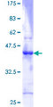 ID3 Protein - 12.5% SDS-PAGE of human ID3 stained with Coomassie Blue