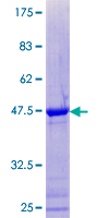 ID4 Protein - 12.5% SDS-PAGE of human ID4 stained with Coomassie Blue