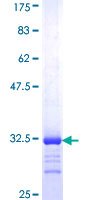 ID4 Protein - 12.5% SDS-PAGE Stained with Coomassie Blue.