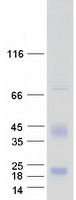 ID4 Protein - Purified recombinant protein ID4 was analyzed by SDS-PAGE gel and Coomassie Blue Staining