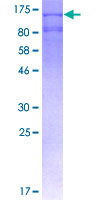 IDE Protein - 12.5% SDS-PAGE of human IDE stained with Coomassie Blue