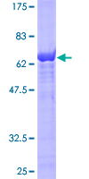 IDH1 / IDH Protein - 12.5% SDS-PAGE of human IDH1 stained with Coomassie Blue
