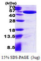 IDH1 / IDH Protein