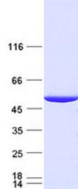 IDH1 / IDH Protein