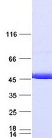 IDH1 / IDH Protein