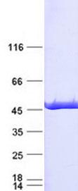 IDH1 / IDH Protein