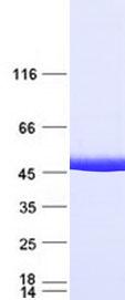 IDH1 / IDH Protein