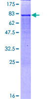 IDH2 Protein - 12.5% SDS-PAGE of human IDH2 stained with Coomassie Blue