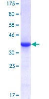 IDH2 Protein - 12.5% SDS-PAGE Stained with Coomassie Blue.