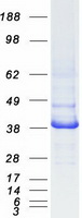 IDH3A Protein - Purified recombinant protein IDH3A was analyzed by SDS-PAGE gel and Coomassie Blue Staining