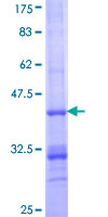 IDH3B Protein - 12.5% SDS-PAGE Stained with Coomassie Blue.