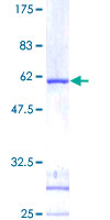 IDI1 / IPP1 Protein - 12.5% SDS-PAGE of human IDI1 stained with Coomassie Blue