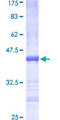 IDI1 / IPP1 Protein - 12.5% SDS-PAGE Stained with Coomassie Blue.