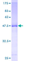 IDI2 Protein - 12.5% SDS-PAGE of human IDI2 stained with Coomassie Blue