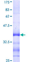 IDN3 / NIPBL Protein - 12.5% SDS-PAGE Stained with Coomassie Blue.