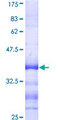 IDN3 / NIPBL Protein - 12.5% SDS-PAGE Stained with Coomassie Blue.
