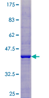 IDNK Protein - 12.5% SDS-PAGE of human C9orf103 stained with Coomassie Blue