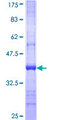 IDNK Protein - 12.5% SDS-PAGE Stained with Coomassie Blue