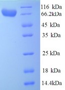 IDUA / MPS1 Protein