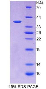 IDUA / MPS1 Protein - Recombinant Iduronidase Alpha L By SDS-PAGE