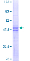 IER3 / IEX-1 Protein - 12.5% SDS-PAGE of human IER3 stained with Coomassie Blue