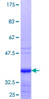 IER3 / IEX-1 Protein - 12.5% SDS-PAGE Stained with Coomassie Blue.