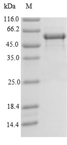IF3mt / MTIF3 Protein - (Tris-Glycine gel) Discontinuous SDS-PAGE (reduced) with 5% enrichment gel and 15% separation gel.