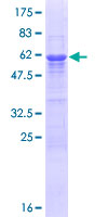 IFFO / IFFO1 Protein - 12.5% SDS-PAGE of human HOM-TES-103 stained with Coomassie Blue