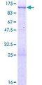 IFI16 Protein - 12.5% SDS-PAGE of human IFI16 stained with Coomassie Blue