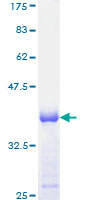 IFI16 Protein - 12.5% SDS-PAGE Stained with Coomassie Blue.