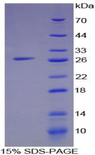 IFI16 Protein - Recombinant Interferon Gamma Inducible Protein 16 By SDS-PAGE