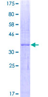 IFI27 / p27 Protein - 12.5% SDS-PAGE of human IFI27 stained with Coomassie Blue