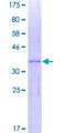 IFI27 / p27 Protein - 12.5% SDS-PAGE of human IFI27 stained with Coomassie Blue