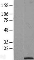 IFI27L1 Protein - Western validation with an anti-DDK antibody * L: Control HEK293 lysate R: Over-expression lysate
