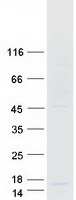 IFI27L1 Protein - Purified recombinant protein IFI27L1 was analyzed by SDS-PAGE gel and Coomassie Blue Staining