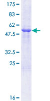 IFI30 / IP30 Protein - 12.5% SDS-PAGE of human IFI30 stained with Coomassie Blue