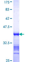 IFI35 Protein - 12.5% SDS-PAGE Stained with Coomassie Blue.