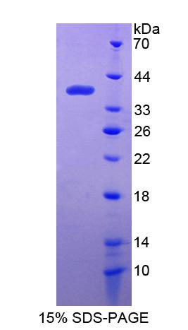 IFI35 Protein - Recombinant Interferon Inducible Protein 35 By SDS-PAGE