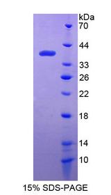 IFI35 Protein - Recombinant Interferon Inducible Protein 35 By SDS-PAGE