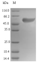 IFI6 / G1P3 Protein - (Tris-Glycine gel) Discontinuous SDS-PAGE (reduced) with 5% enrichment gel and 15% separation gel.
