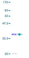 IFI6 / G1P3 Protein - 12.5% SDS-PAGE of human G1P3 stained with Coomassie Blue