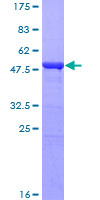 IFIH1 / MDA5 Protein - 12.5% SDS-PAGE of human IFIH1 stained with Coomassie Blue