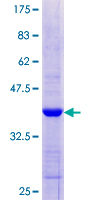 IFIH1 / MDA5 Protein - 12.5% SDS-PAGE Stained with Coomassie Blue.