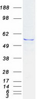 IFIT1 / ISG56 Protein - Purified recombinant protein IFIT1 was analyzed by SDS-PAGE gel and Coomassie Blue Staining