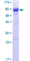 IFIT3 Protein - 12.5% SDS-PAGE of human IFIT3 stained with Coomassie Blue