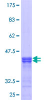 IFIT3 Protein - 12.5% SDS-PAGE Stained with Coomassie Blue.