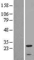 IFITM2 Protein - Western validation with an anti-DDK antibody * L: Control HEK293 lysate R: Over-expression lysate
